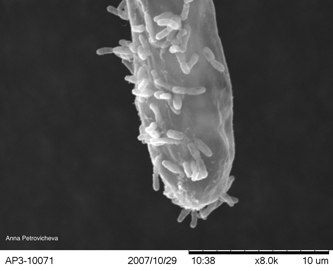 Agrobacterium tumefaciens