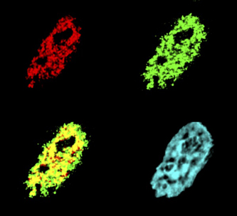 Confocal micrograph of a mammalian cell nucleus stained for a host cofactor and the Moloney murine leukemia virus integrase. The viral protein is green, the host protein is red, the overlap between the proteins is yellow, and the DNA is in blue.
